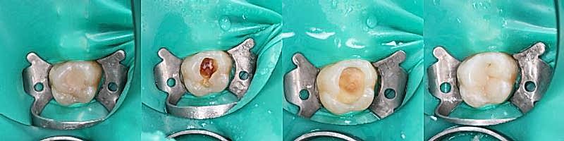 Зубы.jpg Зубы.jpg