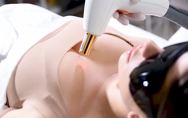 Лазерная шлифовка