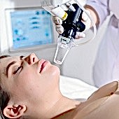 Лазерная шлифовка СО2