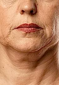 Нечеткий овал лица