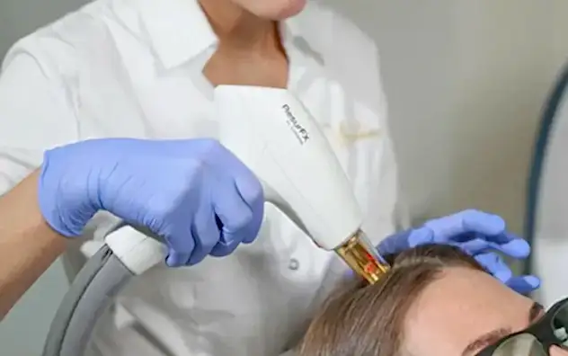 Лазерное лечение кожи головы и восстановление роста волос