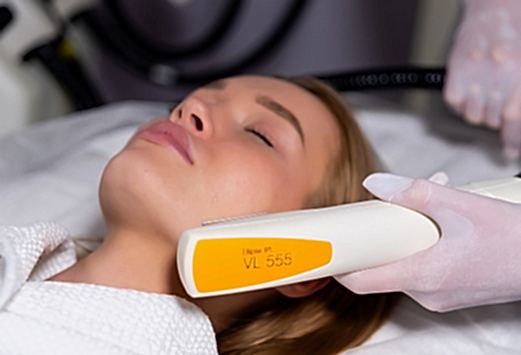 Лазер Candela Nordlys IPL