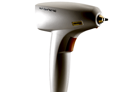 Неодимовый лазер Nd:YAG