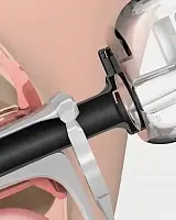 Кольпоскопия